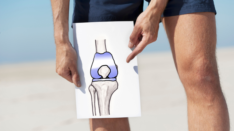 Say Goodbye to Knee Pain: Discover the Power of Regenerative Cell Therapy