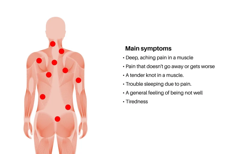 Trigger Point Injections