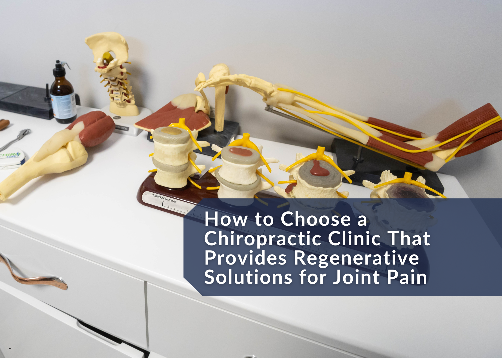 How to Choose a Chiropractic Clinic That Provides Regenerative Solutions for Joint Pain
