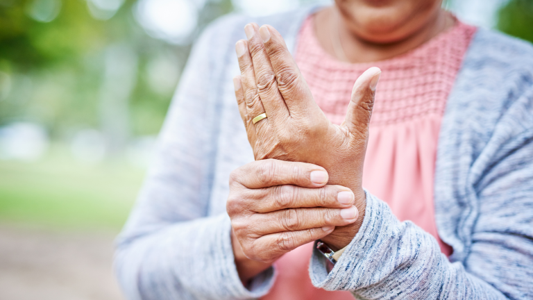Arthritis: Insights into Diagnosis, Treatment, and Long-Term Effects on Joint Health