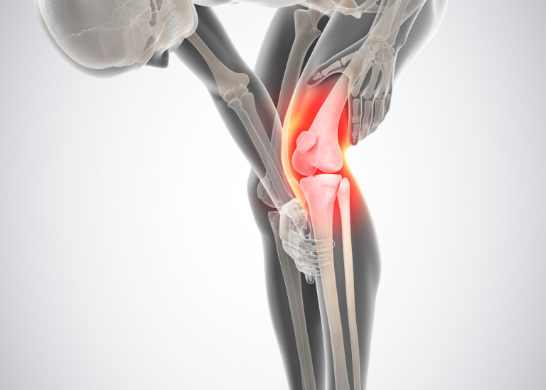 Why Joint Pain Gets Worse Over Time (and How to Stop It)