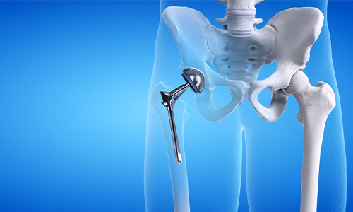 Innovations in Knee and Hip Pain Management: Non-Surgical Approaches